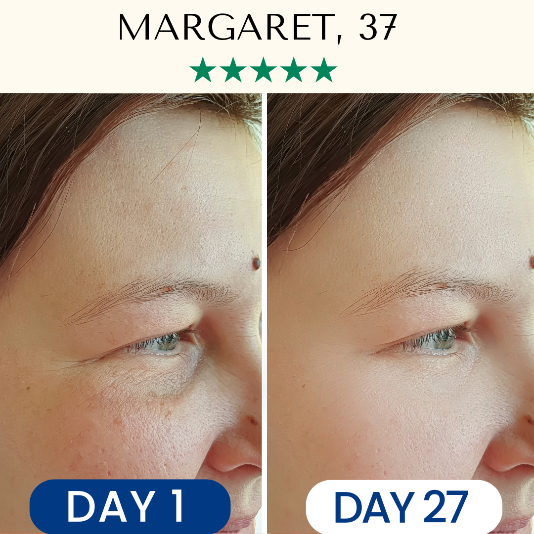 LightPro 7in1 Fontanay™ Lifting Light Therapy