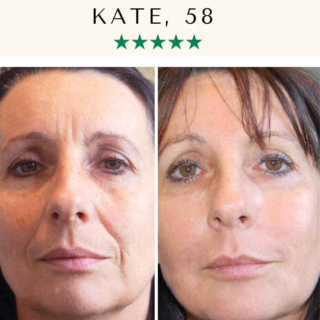 LED Therapy Mask Pro