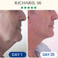 Lifting & Firming Reusable Face Mask Fontanay™