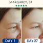 LightPro 7in1 Fontanay™ Lifting Light Therapy