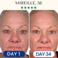 Collagen Mask Fontanay™