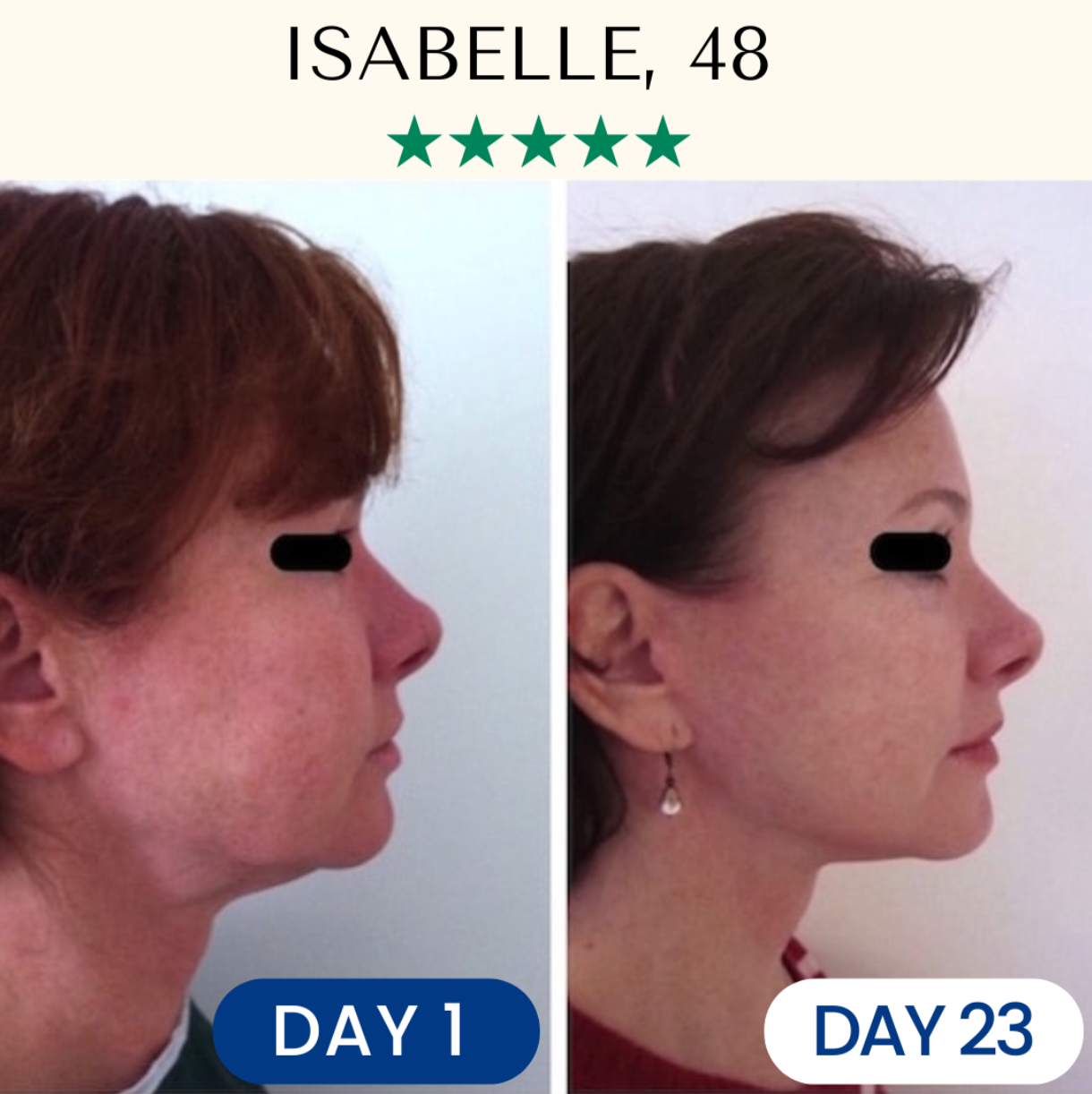 Lifting & Firming Reusable Face Mask Fontanay™