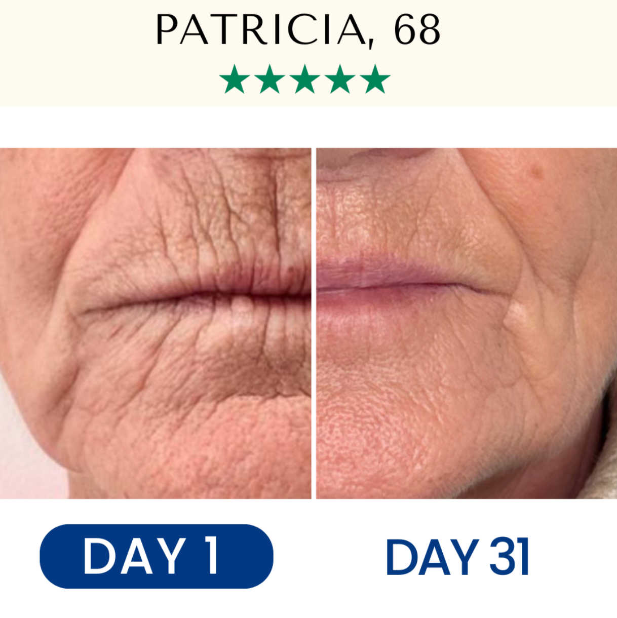 Lifting & Firming Reusable Face Mask Fontanay™