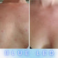 LED Therapy Mask Pro - Neck and Chest