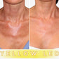 LED Therapy Mask Pro - Neck and Chest