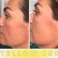LED Therapy Mask Pro