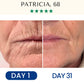 Lifting & Firming Reusable Face Mask Fontanay™