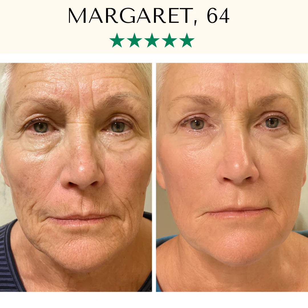 LightPro 7in1 Fontanay™ Lifting Light Therapy