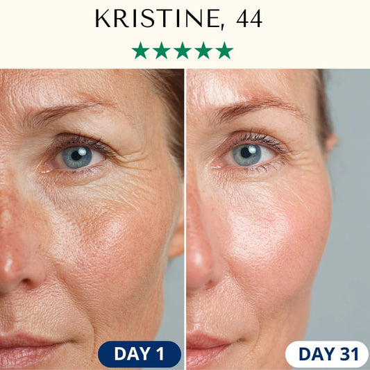 LightPro 7in1 Fontanay™ Lifting Light Therapy