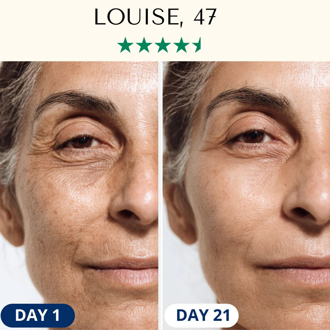 LightPro 7in1 Fontanay™ Lifting Light Therapy