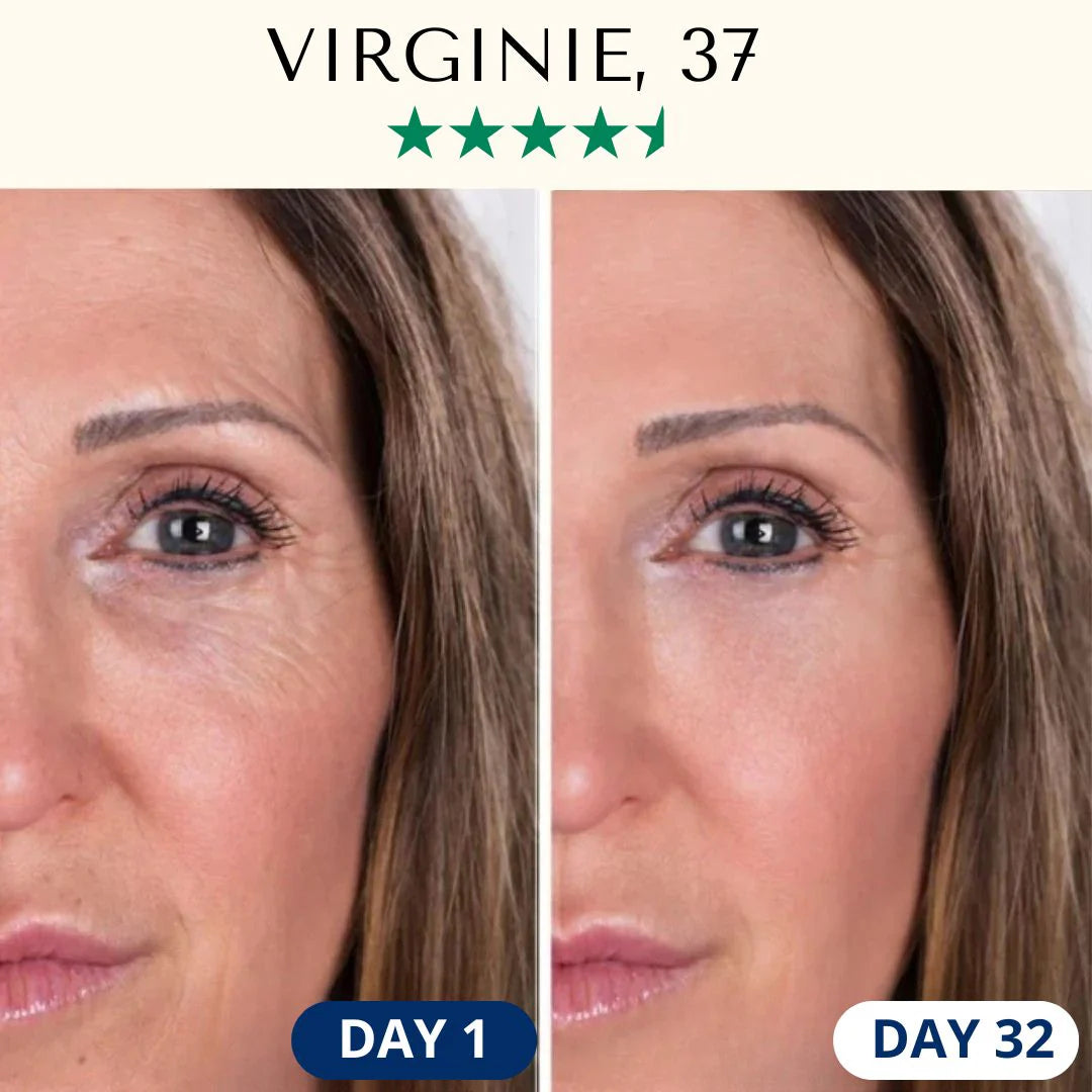 LightPro 7in1 Fontanay™ Lifting Light Therapy