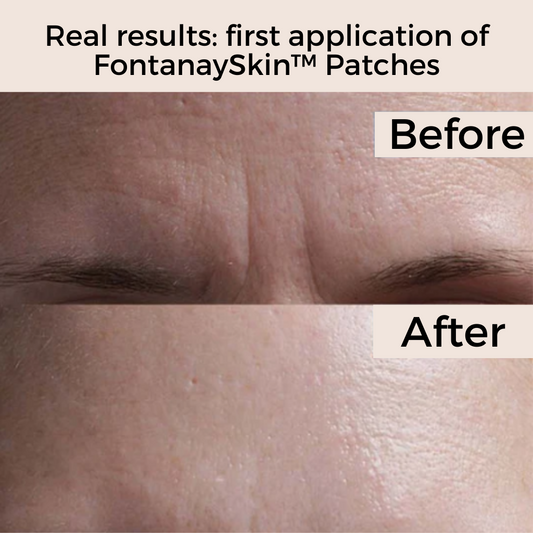 Anti-Wrinkle Reusable Face Patches FontanaySkin™